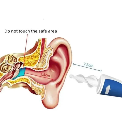 Ear Wax Remover Tool with 16 Silicone Replacement Tips. - 3sung llc
