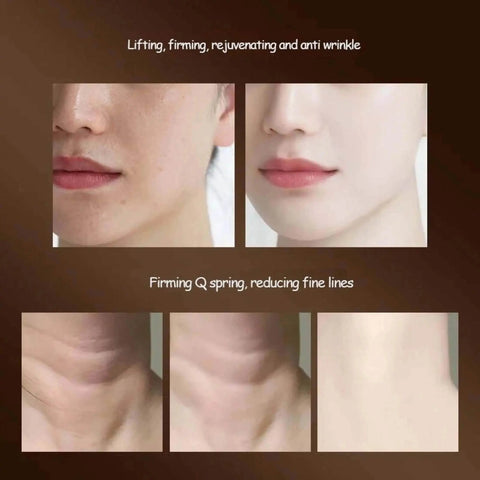 Microcurrent Face Massager for Lifting & Rejuvenation. - 3sung llc