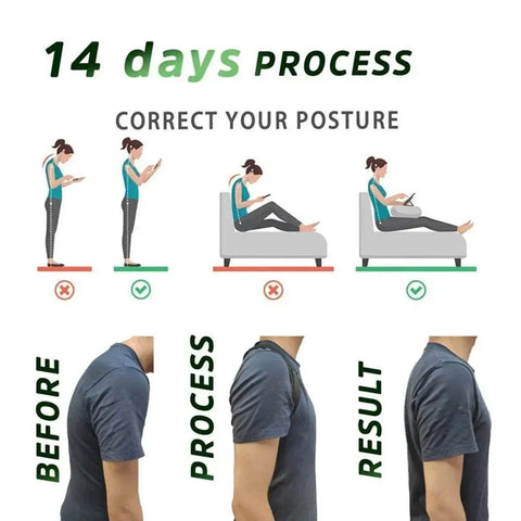 Posture Correction Belt for Men & Women - Hunchback Corrector - 3sung llc